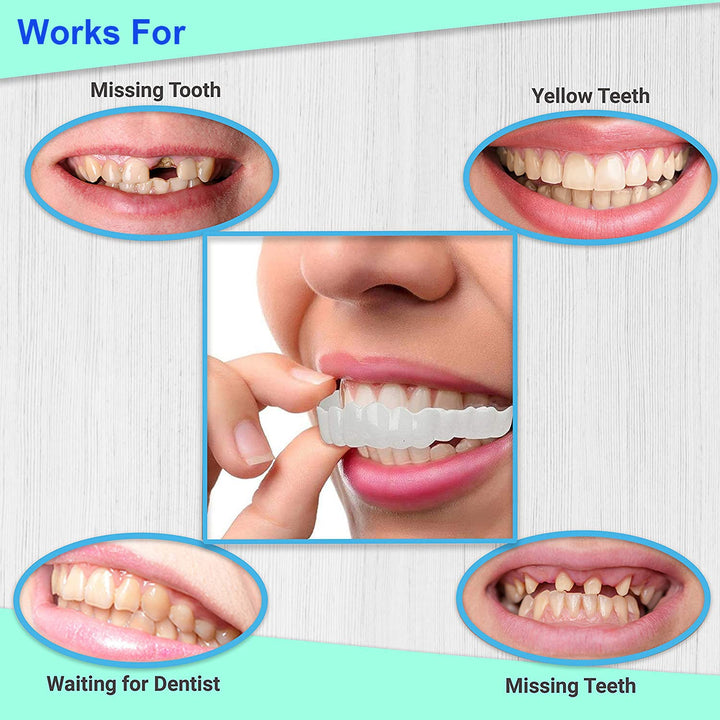 Snap on Smile Veneers - Adjustable Snap on Dentures - Smilo™